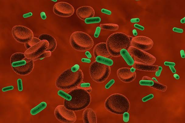 Βακτηρίδια στο αίμα, bacteriemia - Φωτογραφία, εικόνα