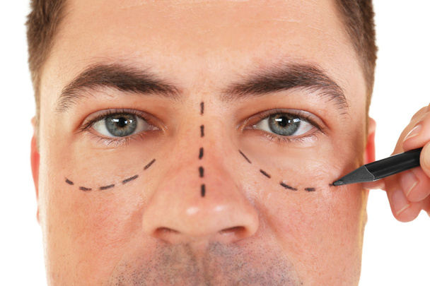 Plastic surgery concept. Hand marking male face - Fotoğraf, Görsel