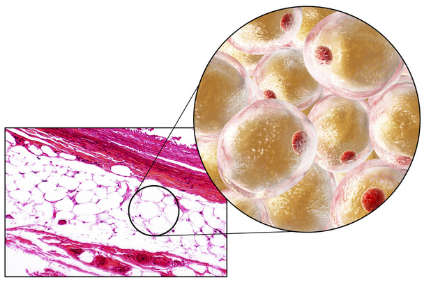 Zsírsejtek, a mikrokamera és a 3D-s illusztráció - Fotó, kép