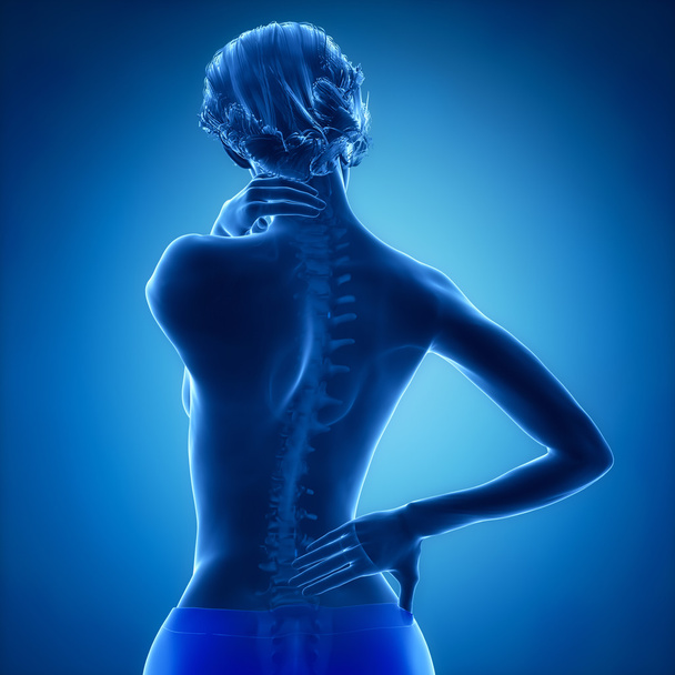 žena má bolesti v krku a zad - Fotografie, Obrázek