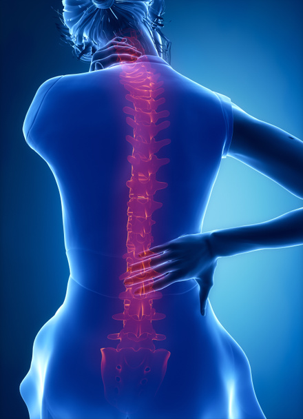 žena má bolesti v krku a zad - Fotografie, Obrázek