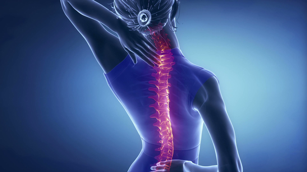 mujer tiene dolor de columna vertebral
 - Metraje, vídeo