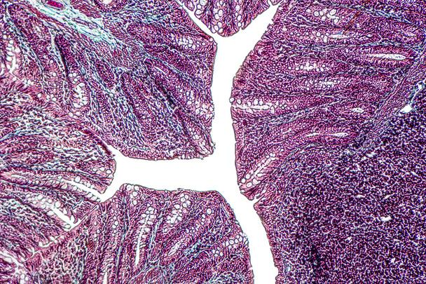 large intestine of a rat - Photo, Image