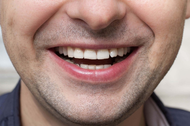 Beau sourire large de jeune homme avec des dents blanches saines
 - Photo, image