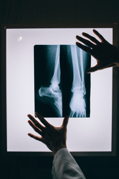 Radiografía del cuerpo humano
 - Foto, Imagen