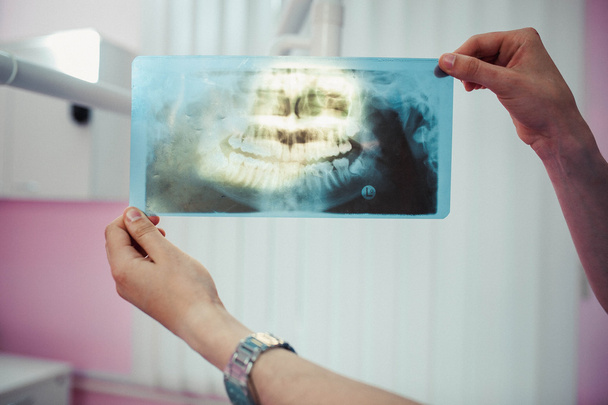 médecin tenant une radiographie des mâchoires humaines
 - Photo, image