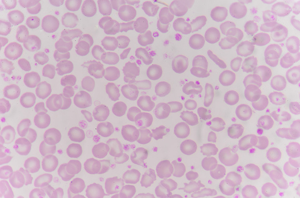 červených krvinek s pozadím bílých krvinek. - Fotografie, Obrázek