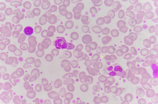 red blood cells with white blood cells background. - Photo, Image