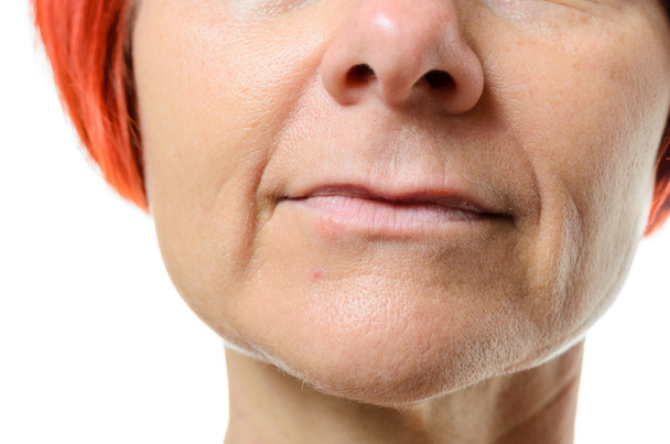 Woman with blemish on chin - Fotoğraf, Görsel