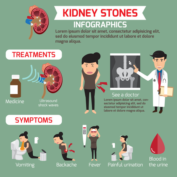 Treatment and symptoms of kidney infographics. vector illustrati - Vector, Image