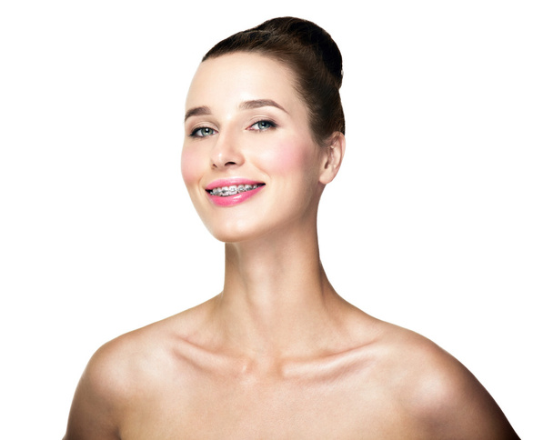 Beautiful young woman with teeth braces  - Фото, зображення