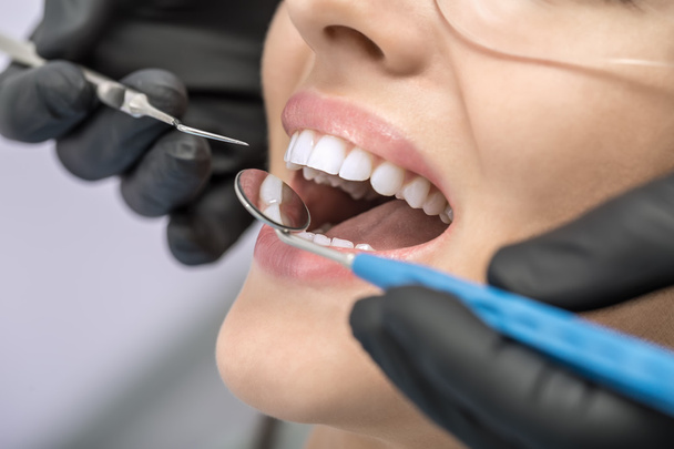 Patients teeth checking - Фото, изображение