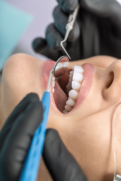 Womans teeth checking - Φωτογραφία, εικόνα