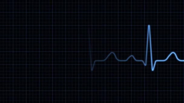 Électrocardiogramme - Séquence, vidéo