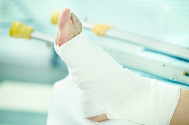 broken leg in bandage  - Photo, Image