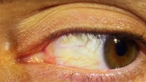 Eye Rotation Of The Eyeball - Footage, Video