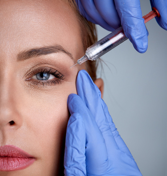 woman during surgery filling facial wrinkles - Photo, image