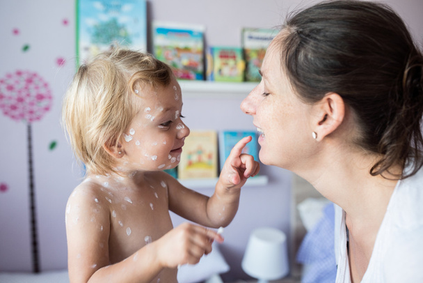 Little girl with chickenpox and mother - Photo, Image