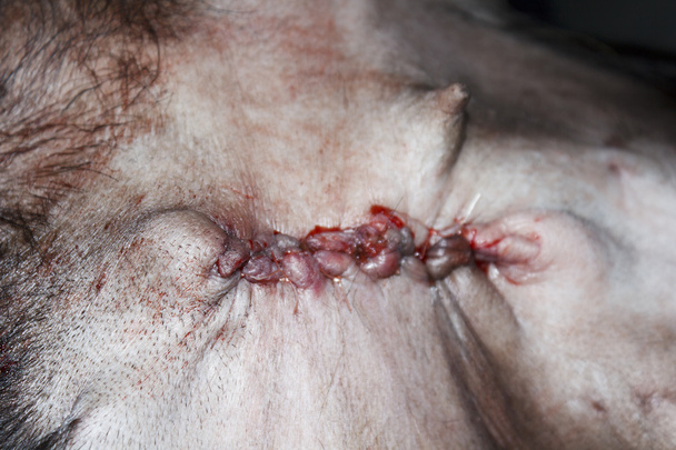 ferida de sutura
 - Foto, Imagem