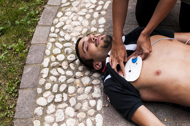 girl applying defibrillator electrodes for CPR with defibrillator - 写真・画像