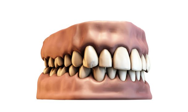 Teeth with gums - Photo, Image