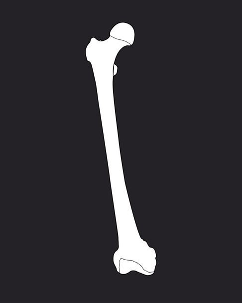 大腿骨骨のイラスト - 写真・画像