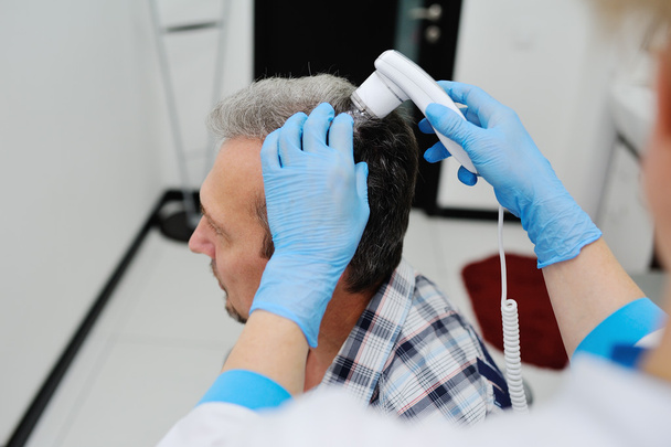 baldness. diagnostics hair and scalp - Foto, immagini