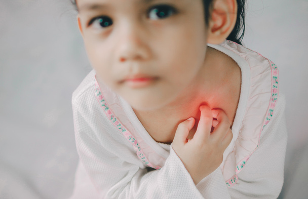 Azië jong meisje krassen op de jeuk met hand, hals, jeuk, gezondheidszorg en geneeskunde Concept - Foto, afbeelding