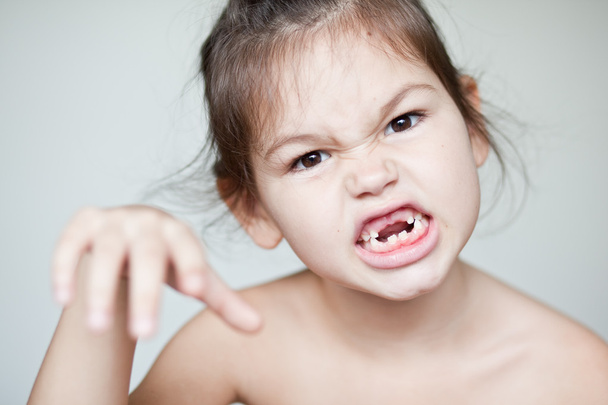 Menina mostrando seus dentes de leite desaparecidos
 - Foto, Imagem