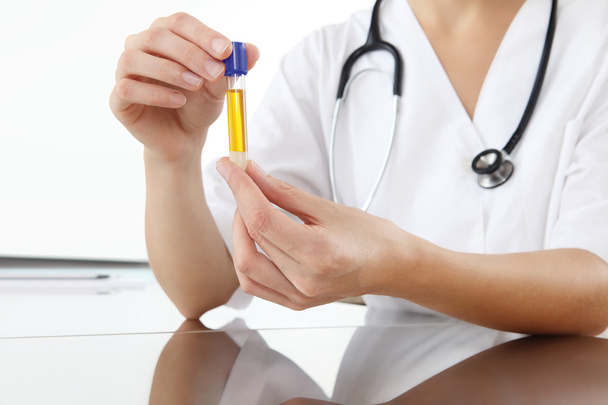 hands doctor holding test tube with yellowish fluid - Фото, зображення