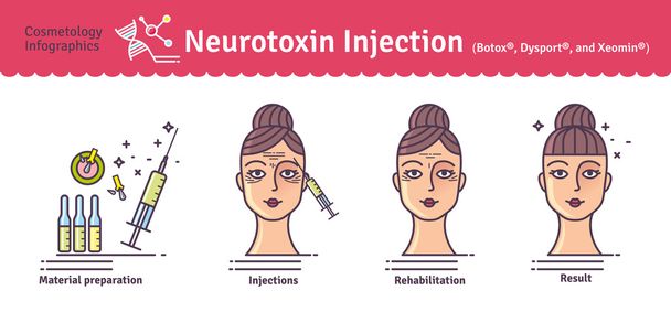 Vektor illustriertes Set mit kosmetologischen Botox-Injektionen - Vektor, Bild