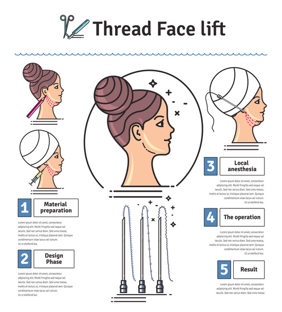 Vector Illustrated set with face lifting surgery by threads - Vector, Image
