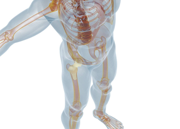 Modelo de reemplazo de cadera
 - Foto, imagen