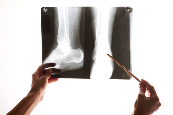 mano sosteniendo los pies de imagen de rayos X sobre un fondo blanco
 - Foto, imagen