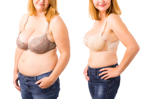 Femme avant et après la perte de poids
 - Photo, image