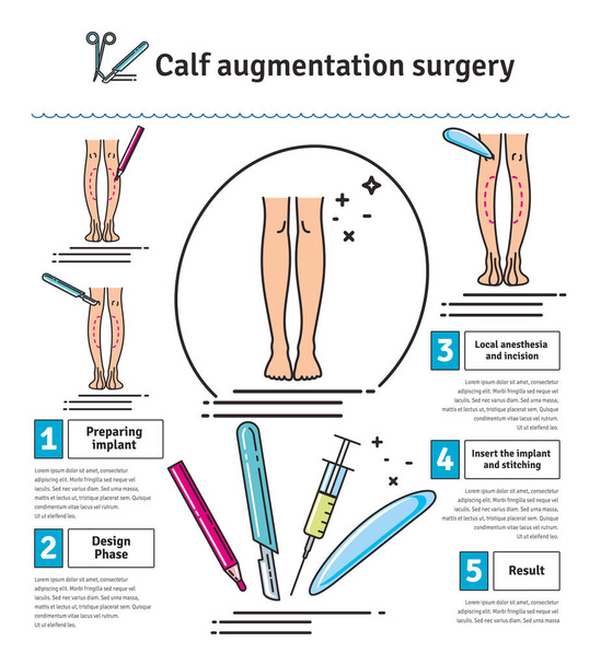 Vector Illustrated set with calf augmentation surgery - Vector, Image