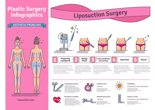 Vector Illustrated set with liposuction surgery - Vector, Image