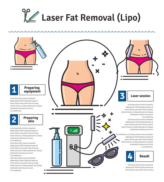 Conjunto ilustrado vetorial com remoção de gordura a laser LIPO
 - Vetor, Imagem