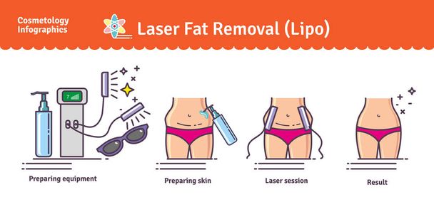 Vector Illustrated set with Laser LIPO Fat Removal - Vector, Image