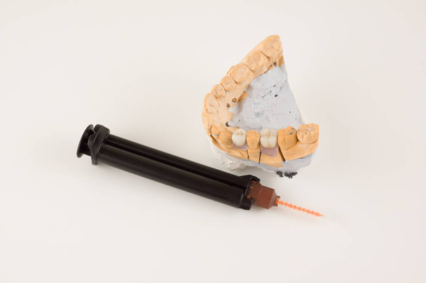 étape de fabrication de prothèses dentaires
 - Photo, image