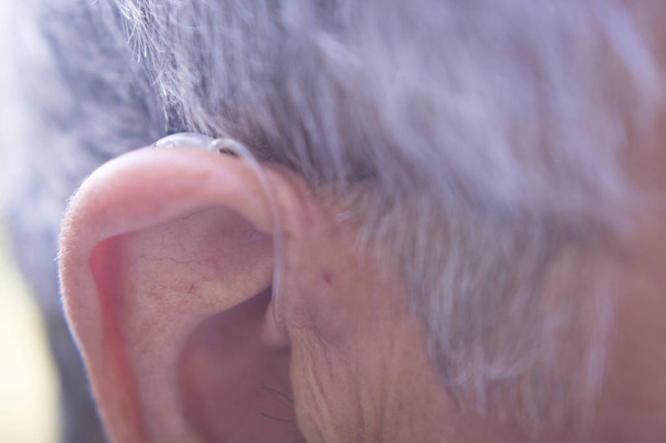 Modern digitális hallókészülék - Fotó, kép