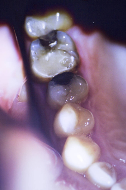 Οδοντιατρική δόντια φωτογραφία Οδοντίατροι - Φωτογραφία, εικόνα