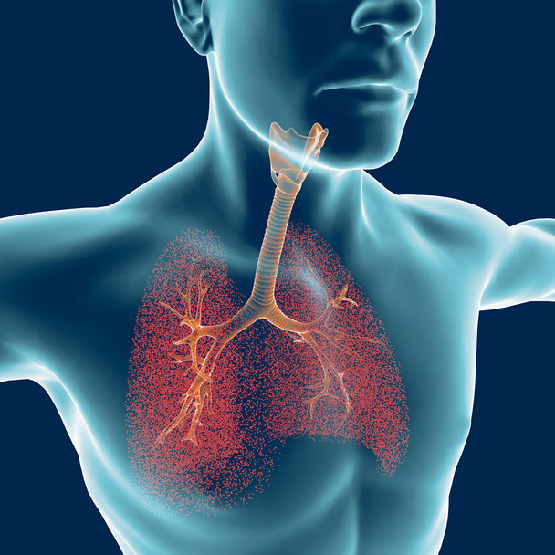 Bronchien, der menschliche Körper, der Mensch, die Lungen, Entzündungen - Foto, Bild