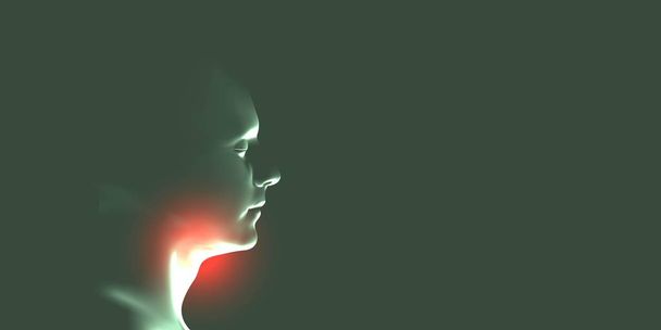 Laryngitis vector illustration. Human throat irritation. - Vector, Image