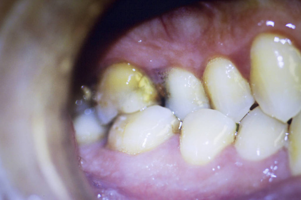 Οδοντιατρική δόντια φωτογραφία Οδοντίατροι - Φωτογραφία, εικόνα