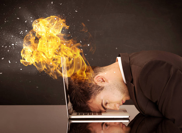 Stressed business man's head is burning - Foto, Imagen