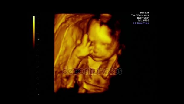 Υπερηχογράφημα του ένα όμορφο μωρό - Πλάνα, βίντεο