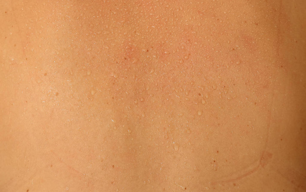 Человеческая кожа и пот
 - Фото, изображение