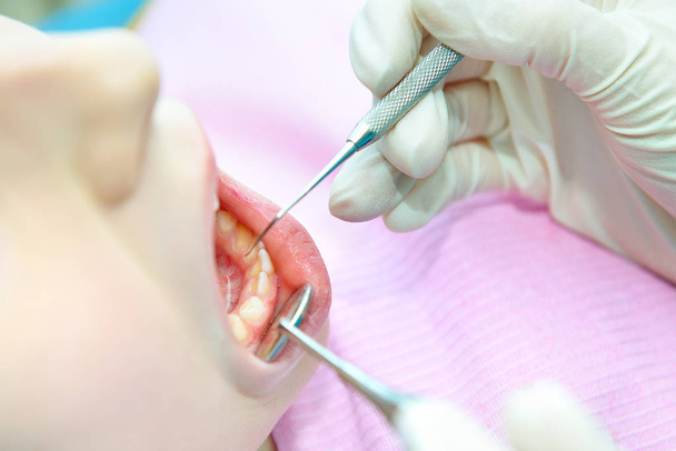 dentista cura paciente criança
 - Foto, Imagem
