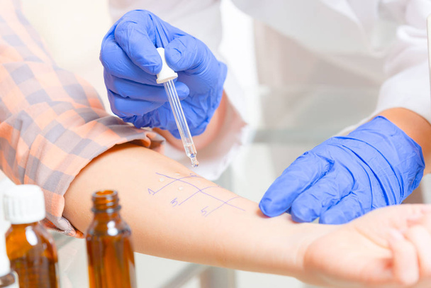 Allergy tests in laboratory - Photo, Image